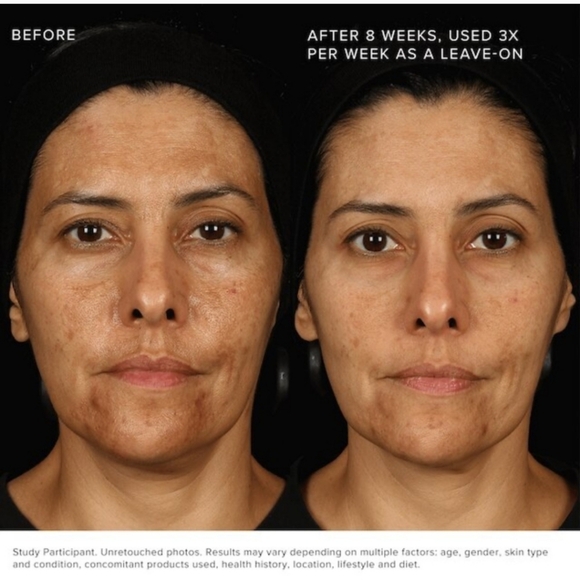 FACE PEEL R+F Multi-Acid Enzyme Peel New in Box Sealed - Picture 11 of 15